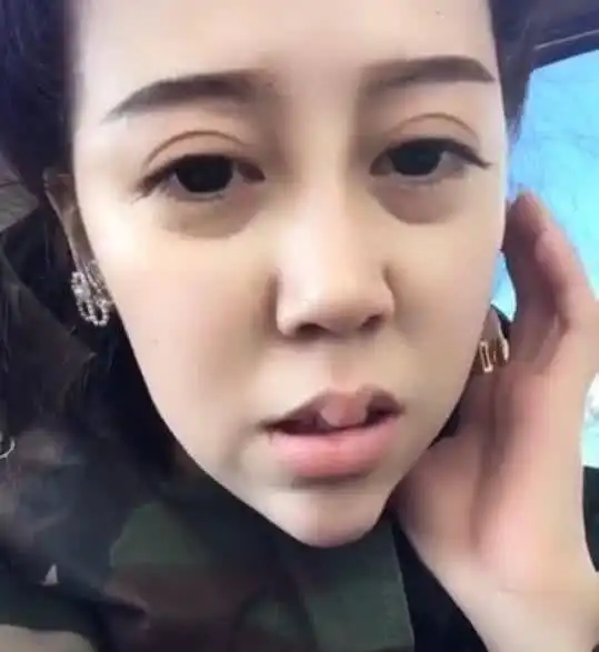 翻版雷震子整容失败,假体明显看着吓人