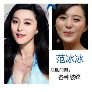 女神美貌都是假象ps前斑点密布皱纹多