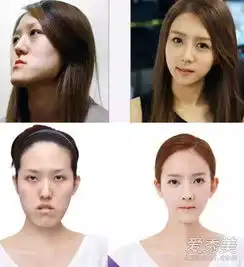 韩国整容节目中最火的4大案例图