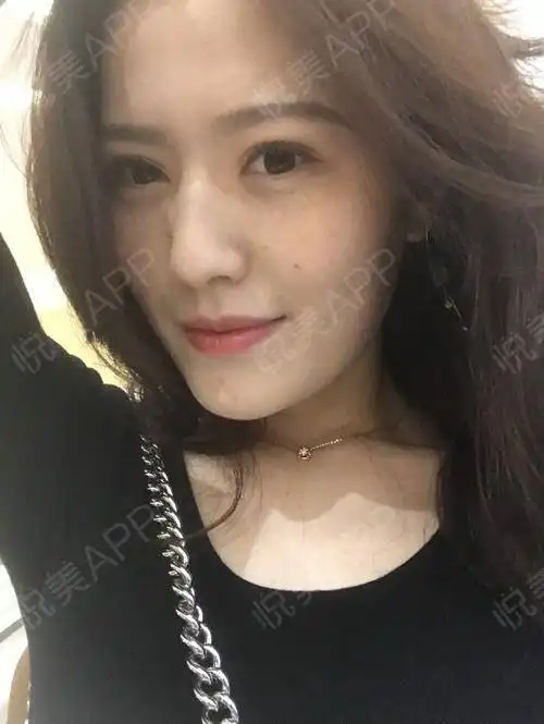 回想起大学女生的生活真是好多搞笑的事情,那个时候网...开眼角悦美整形