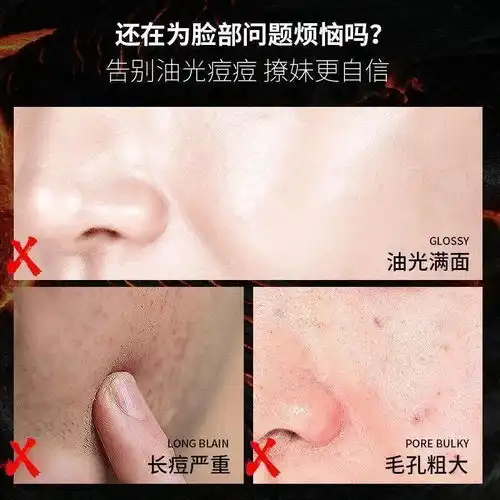 抢抢抢男士洗面奶洁面乳清爽保湿清洁毛孔控油祛痘去黑头除螨虫深层清洁