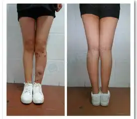 肤白貌美大长腿一个女孩儿的长腿梦