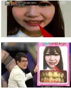 妹子整容成瘾变假人大尺度无下限的日韩综艺