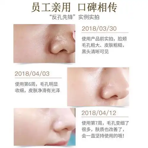 撕拉面膜美白补水学生女祛斑去黑头粉刺鼻贴去角质去死皮祛痘神器