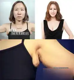 韩国整容节目中年大婶变小张曼玉
