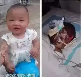 茶几上这个东西突然爆炸5岁女孩右眼被炸伤近乎失明家家都有