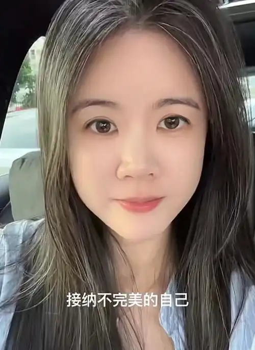 扎心了广东36岁美女年纪轻轻满头白发,两年和解了,评论区炸锅