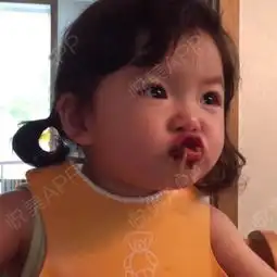 今天晚上就...眼综合悦美整形