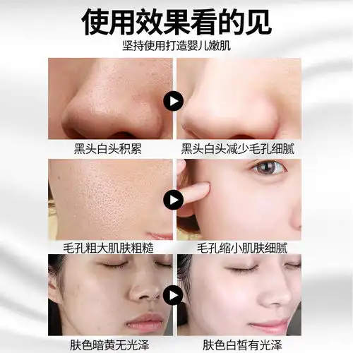 抖音同款排毒膏排毒素脸部竹炭净化平衡按摩膏祛痘膏正品深层清洁