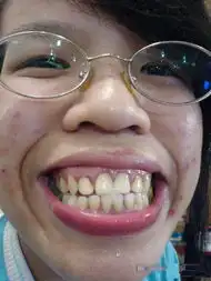 同问网络十大丑女,各类的丑,哈哈有没有她们更丑的