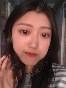 现在的我就是一个字,美美美,成功从小土妞变身大美女...垫鼻尖悦美整形