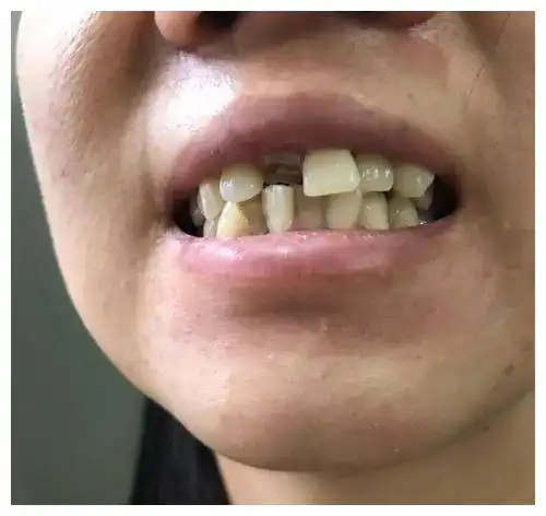 女性45岁后要重视养生,常吃4种零食,补充雌激素,延缓衰老