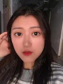 现在的我就是一个字,美美美,成功从小土妞变身大美女...垫鼻尖悦美整形