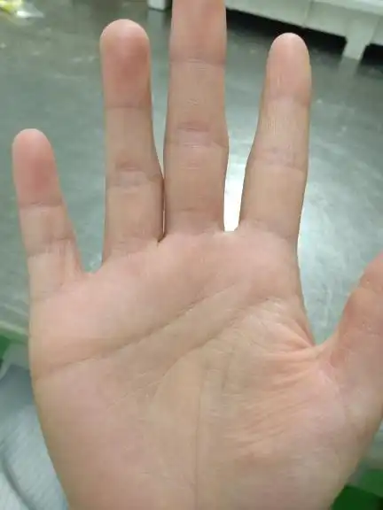 听说女人右手断掌不好是吗,看看我这个是不是断掌掌纹,求大神懂的告诉我一下