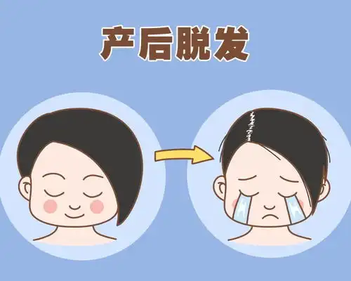 产后脱发不要慌,试试这样做