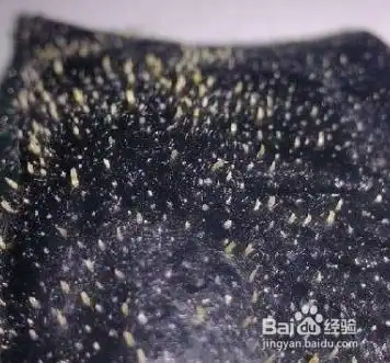 如何消除黑头